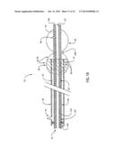 Embolic Protection Device Having Expandable Trap diagram and image