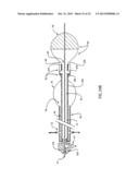 Embolic Protection Device Having Expandable Trap diagram and image