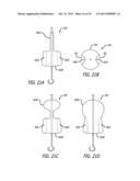 Valvuloplasty Catheter diagram and image