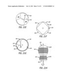 Valvuloplasty Catheter diagram and image