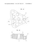 BONE PLATE AIMING BLOCK diagram and image