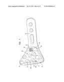 BONE PLATE AIMING BLOCK diagram and image