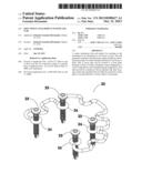 SOFT TISSUE ATTACHMENT SYSTEM AND CLIP diagram and image