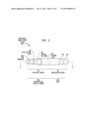 IMPLANTABLE ACOUSTIC SENSOR diagram and image