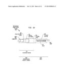 IMPLANTABLE ACOUSTIC SENSOR diagram and image