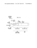 IMPLANTABLE ACOUSTIC SENSOR diagram and image