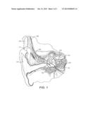 Non-Pressure Sensitive Implantable Microphone diagram and image