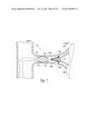 CATHETER ASSEMBLIES FOR NEUROMODULATION PROXIMATE A BIFURCATION OF A RENAL     ARTERY AND ASSOCIATED SYSTEMS AND METHODS diagram and image