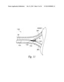 CATHETER ASSEMBLIES FOR NEUROMODULATION PROXIMATE A BIFURCATION OF A RENAL     ARTERY AND ASSOCIATED SYSTEMS AND METHODS diagram and image