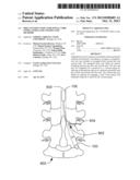 IMPLANTATION TOOLS FOR SPINAL CORD STIMULATOR LEADS AND RELATED METHODS diagram and image