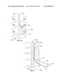 IMPLANTATION TOOLS FOR SPINAL CORD STIMULATOR LEADS AND RELATED METHODS diagram and image