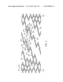 STENT WITH FLEXIBLE HINGES diagram and image