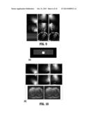 EIGEN-VECTOR APPROACH FOR COIL SENSITIVITY MAPS ESTIMATION diagram and image