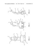 MOUTH GUARD RETAINING DEVICE diagram and image