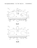 METHOD OF MANUFACTURING AN ORTHODONTIC BRACKET HAVING A LASER SHAPED GREEN     BODY diagram and image