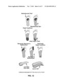 INSOLE AND FOOT ORTHOTICS MADE OF SHAPE MEMORY MATERIAL (SMM)     THREE-DIMENSIONAL SPACER FABRICS diagram and image