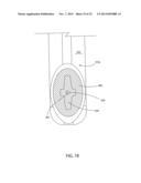 FLOSS PICK diagram and image