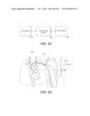 Manifold Diaphragms diagram and image