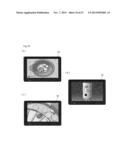 MEDICINE FEEDING DEVICE AND A MEDICINE COUNTING DEVICE USING THE MEDICINE     FEEDING DEVICE diagram and image