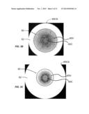 LIGHT-COUPLING OPTICAL SYSTEMS AND METHODS EMPLOYING LIGHT-DIFFUSING     OPTICAL FIBER diagram and image