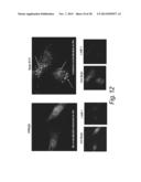 TREATMENT OF SANFILIPPO SYNDROME TYPE B diagram and image