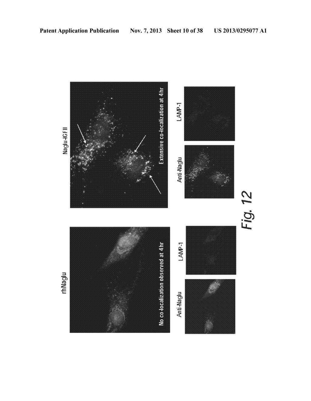 TREATMENT OF SANFILIPPO SYNDROME TYPE B - diagram, schematic, and image 11