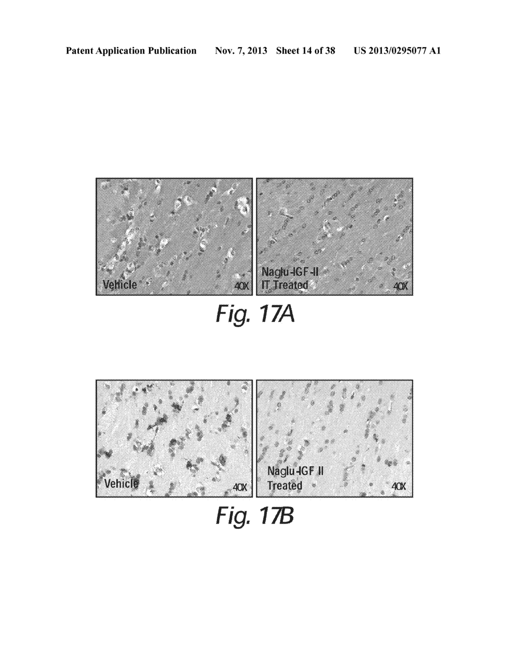 TREATMENT OF SANFILIPPO SYNDROME TYPE B - diagram, schematic, and image 15