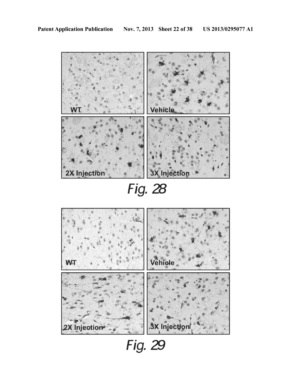 TREATMENT OF SANFILIPPO SYNDROME TYPE B - diagram, schematic, and image 23