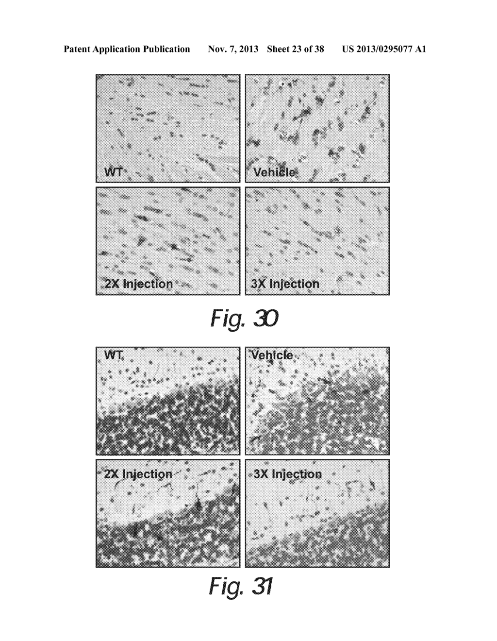 TREATMENT OF SANFILIPPO SYNDROME TYPE B - diagram, schematic, and image 24