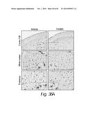 TREATMENT OF SANFILIPPO SYNDROME TYPE B diagram and image