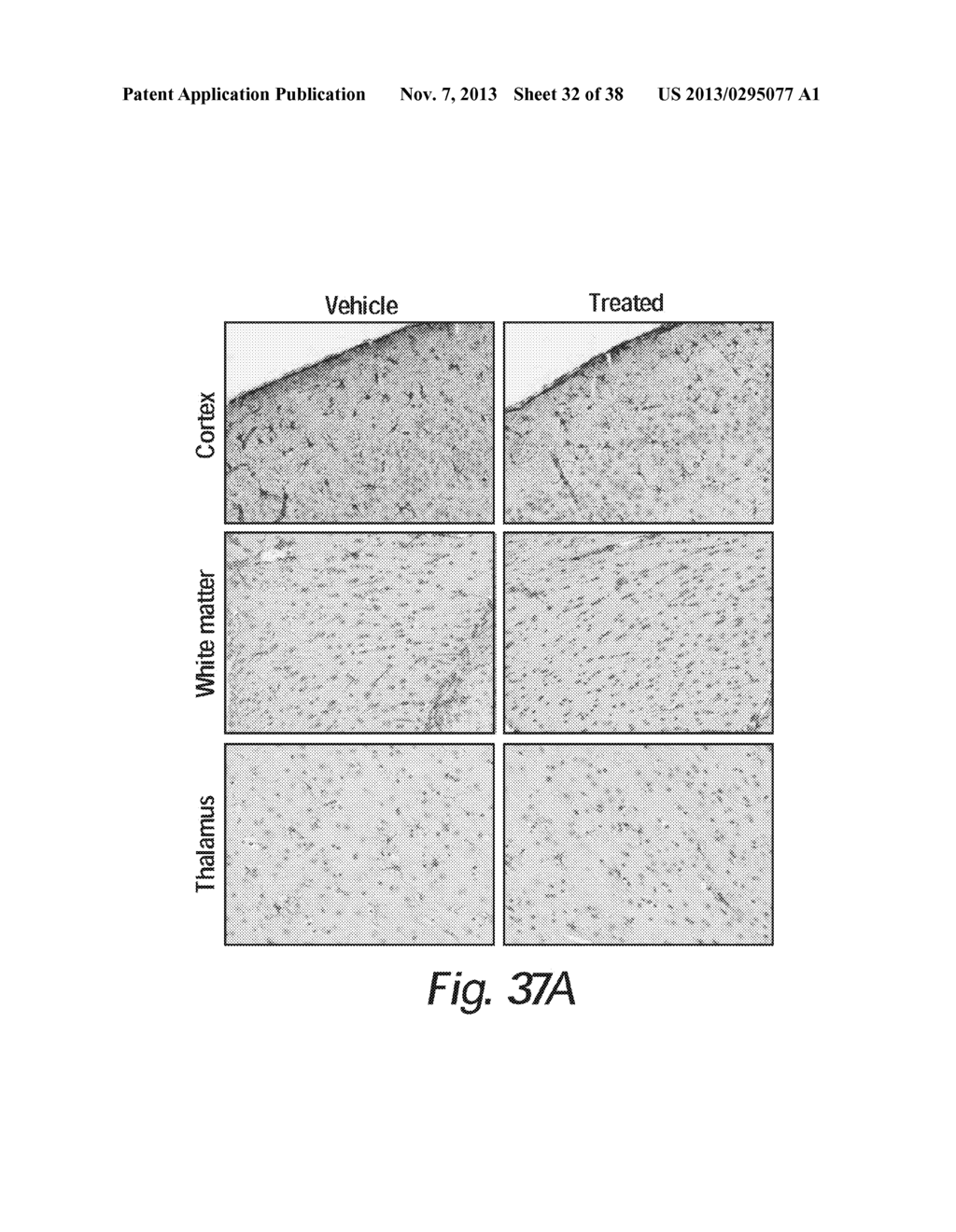 TREATMENT OF SANFILIPPO SYNDROME TYPE B - diagram, schematic, and image 33