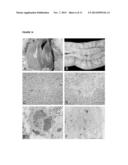 VACCINES FOR INCLUSION BODY HEPATITIS diagram and image