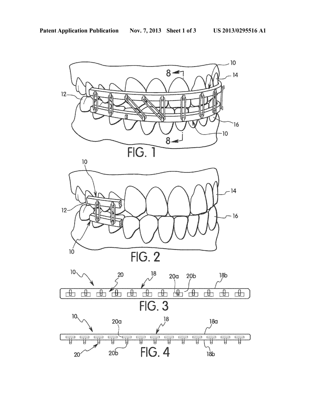 SINGER-DOMANSKI RESIN MMF/REIMPLANTATION DEVICE - diagram, schematic, and image 02