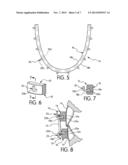 SINGER-DOMANSKI RESIN MMF/REIMPLANTATION DEVICE diagram and image