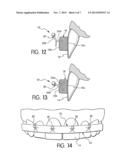 SINGER-DOMANSKI RESIN MMF/REIMPLANTATION DEVICE diagram and image