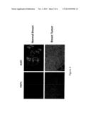 Methods and Compositions for the Treatment and Diagnosis of Breast Cancer diagram and image