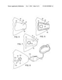 LEASH ANCHOR FOR SURFBOARD diagram and image