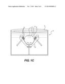 METHOD FOR DEBRISTLING ANIMAL SKIN diagram and image