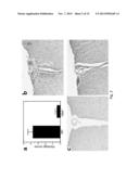 METHODS OF BLOCKING TISSUE DESTRUCTION BY AUTOREACTIVE T CELLS diagram and image