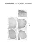 METHODS OF BLOCKING TISSUE DESTRUCTION BY AUTOREACTIVE T CELLS diagram and image