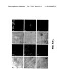 TARGETING EN2, PAX2, AND/OR DEFB1 FOR TREATMENT OF PROSTATE CONDITIONS diagram and image