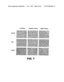 TARGETING EN2, PAX2, AND/OR DEFB1 FOR TREATMENT OF PROSTATE CONDITIONS diagram and image