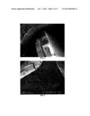 SUPERABSORBENT SURFACE-TREATED CARBOXYLATED POLYSACCHARIDES AND PROCESS     FOR PRODUCING SAME diagram and image