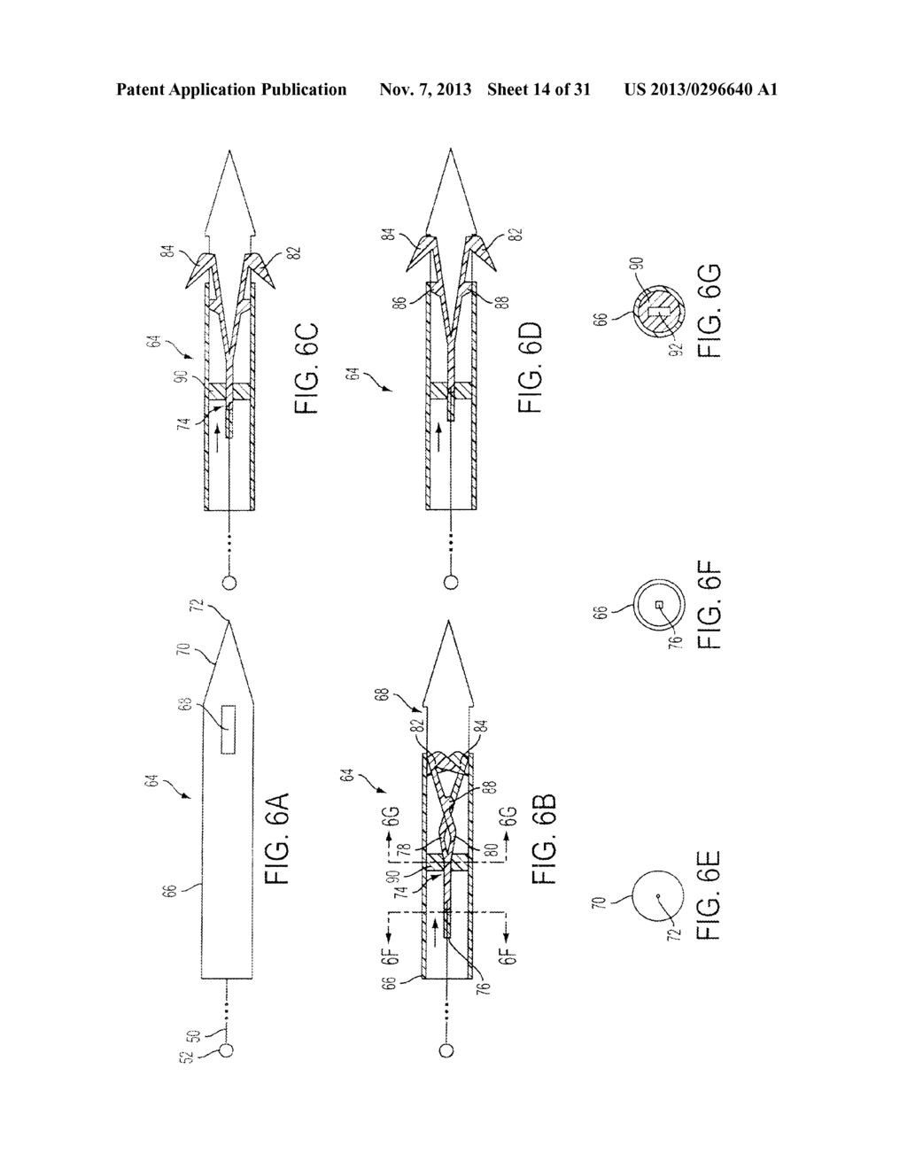 ATRAUMATIC MEDICAL DEVICE ANCHORING AND DELIVERY SYSTEM WITH ENHANCED     ANCHORING - diagram, schematic, and image 15