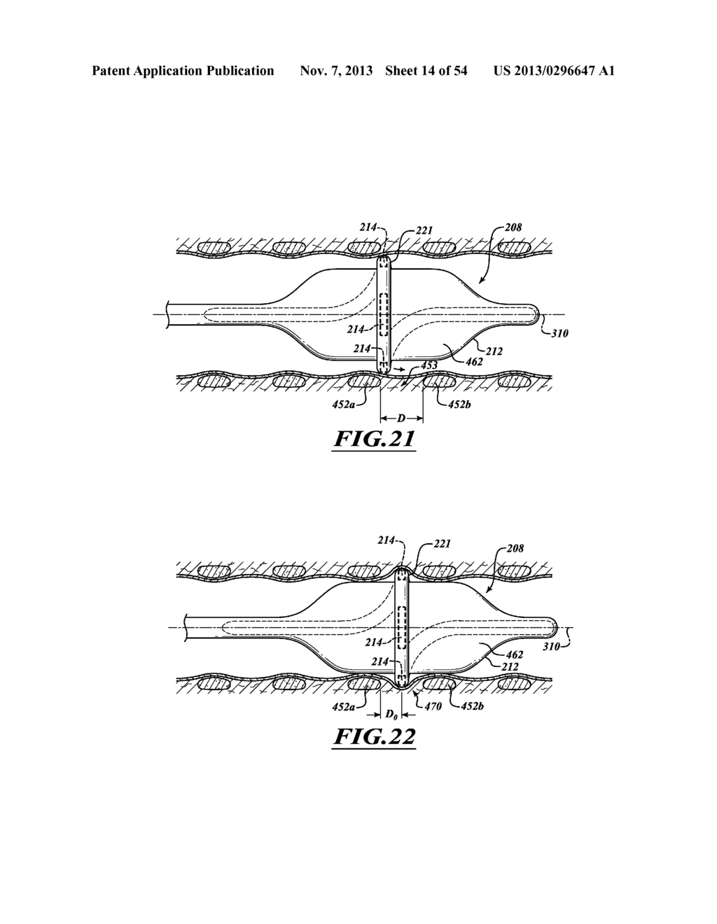 DELIVERY DEVICES WITH COOLABLE ENERGY EMITTING ASSEMBLIES - diagram, schematic, and image 15