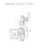 ANGLE DISTRIBUTION TECHNIQUE FOR ANALYZING A PHYSIOLOGICAL SENSOR SIGNAL diagram and image