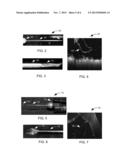 SURGICAL INSTRUMENTS FOR OCT ASSISTED PROCEDURES diagram and image