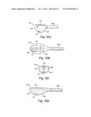 Apparatus and Methods for Low-Cost Intravascular Ultrasound Imaging and     for Crossing Severe Vascular Occlusions diagram and image