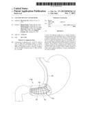 SATIATION DEVICES AND METHODS diagram and image