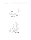 SATIATION DEVICES AND METHODS diagram and image